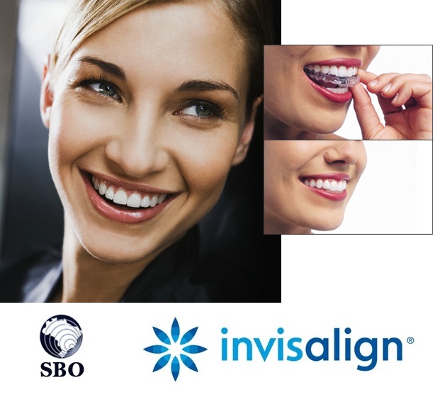 Sociedade Brasileira de Ortodontia promove curso sobre Invisalign